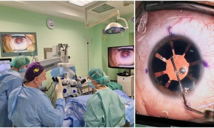 Hospital in Split implants an artificial iris for first time